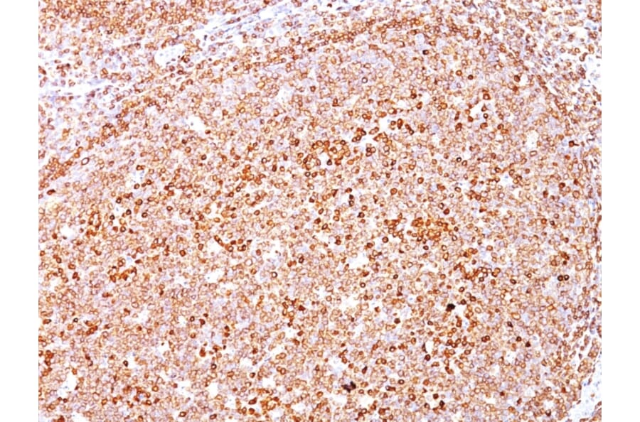 Immunohistochemistry - Anti-CD79a Antibody [SPM550] (A250784) - Antibodies.com