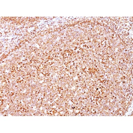 Immunohistochemistry - Anti-CD79a Antibody [SPM550] (A250784) - Antibodies.com