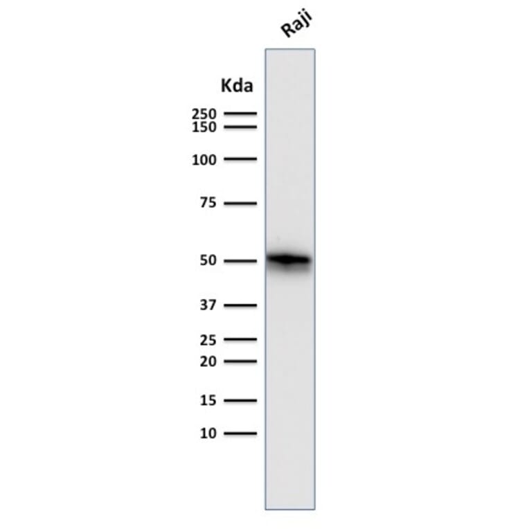 Western Blot - Anti-CD79a Antibody [SPM550] (A250784) - Antibodies.com