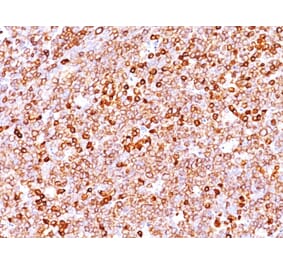 Immunohistochemistry - Anti-CD79a Antibody [JCB117 + HM47/A9] (A250785) - Antibodies.com