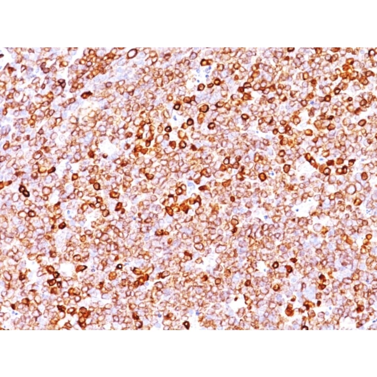 Immunohistochemistry - Anti-CD79a Antibody [JCB117 + HM47/A9] (A250785) - Antibodies.com