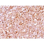 Immunohistochemistry - Anti-CD79a Antibody [JCB117 + HM47/A9] (A250785) - Antibodies.com