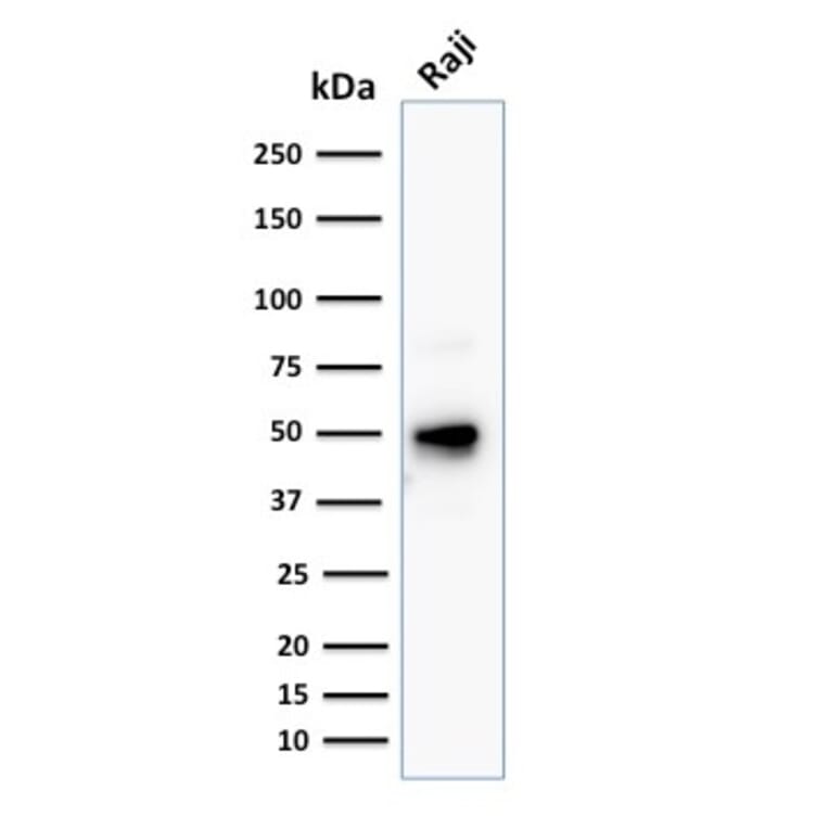 Western Blot - Anti-CD79a Antibody [JCB117 + HM47/A9] (A250785) - Antibodies.com