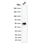 Western Blot - Anti-CD79a Antibody [JCB117 + HM47/A9] (A250785) - Antibodies.com