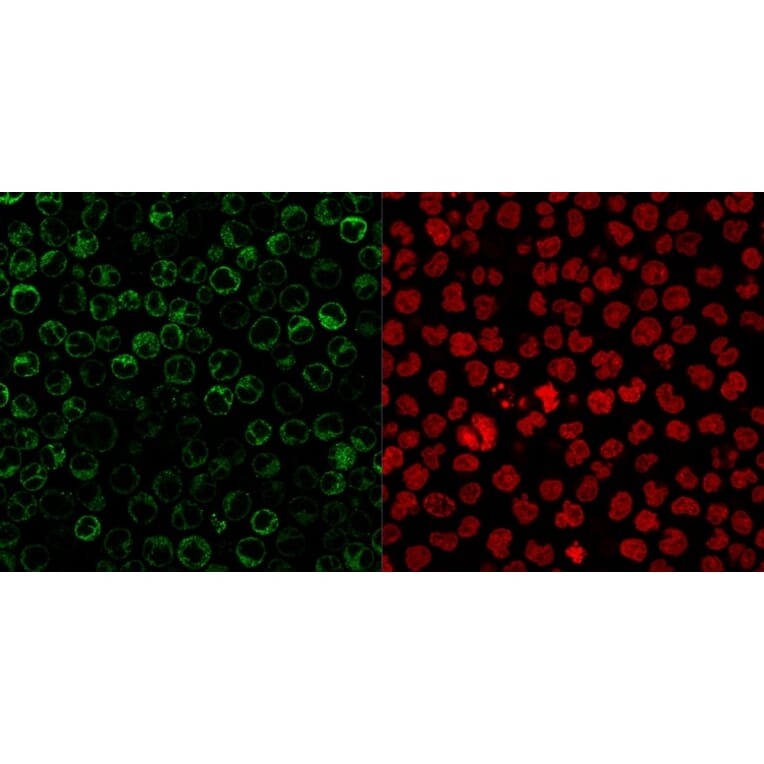 Immunofluorescence - Anti-CD79a Antibody [JCB117 + HM47/A9] (A250785) - Antibodies.com