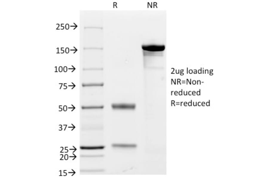 SDS-PAGE - Anti-CD79a Antibody [JCB117 + HM47/A9] (A250785) - Antibodies.com