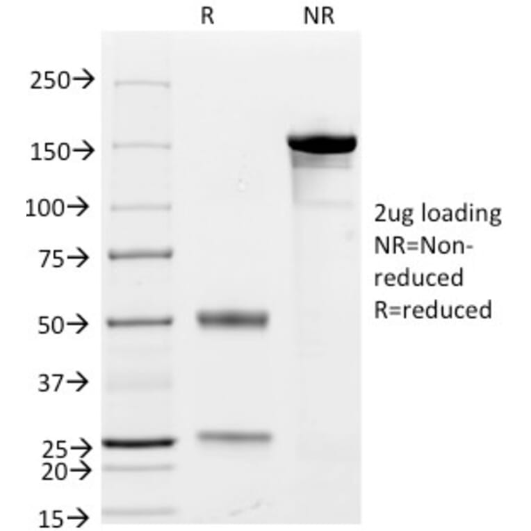 SDS-PAGE - Anti-CD79a Antibody [JCB117 + HM47/A9] (A250785) - Antibodies.com