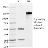 SDS-PAGE - Anti-CD79a Antibody [JCB117 + HM47/A9] (A250785) - Antibodies.com