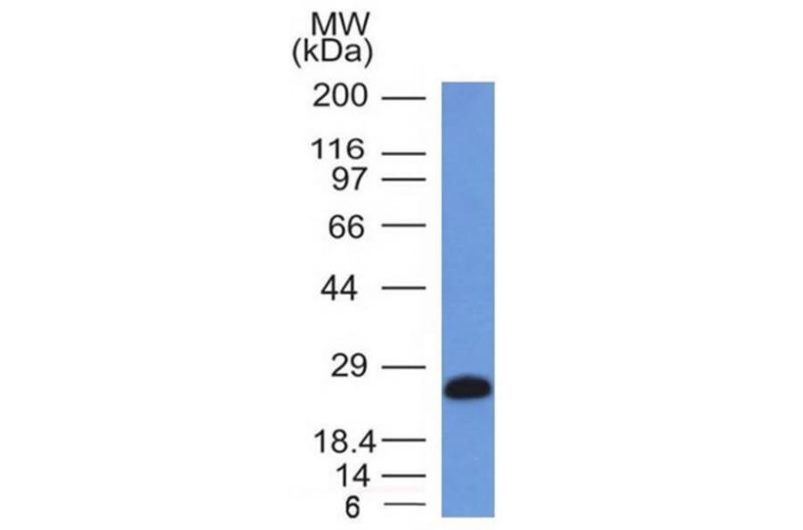 Western Blot - Anti-CD79a Antibody [IGA/1406] (A250788) - Antibodies.com
