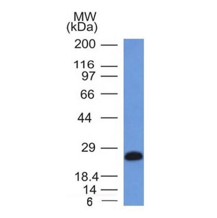 Western Blot - Anti-CD79a Antibody [IGA/1406] (A250788) - Antibodies.com