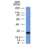 Western Blot - Anti-CD79a Antibody [IGA/1406] (A250788) - Antibodies.com