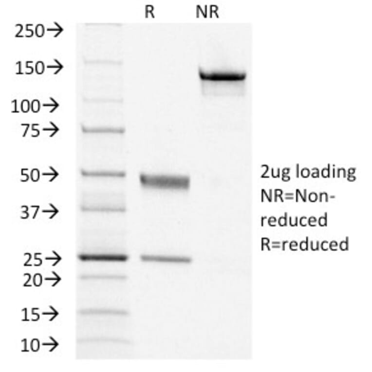 SDS-PAGE - Anti-CD79a Antibody [IGA/1406] (A250787) - Antibodies.com