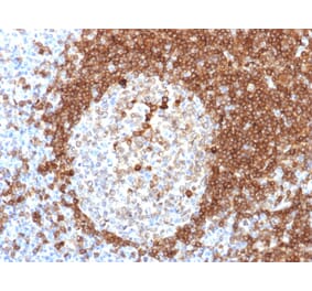 Immunohistochemistry - Anti-CD79a Antibody [HM57] (A250789) - Antibodies.com