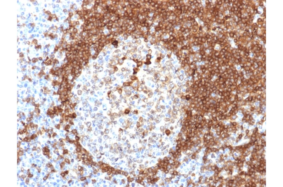 Immunohistochemistry - Anti-CD79a Antibody [HM57] (A250789) - Antibodies.com