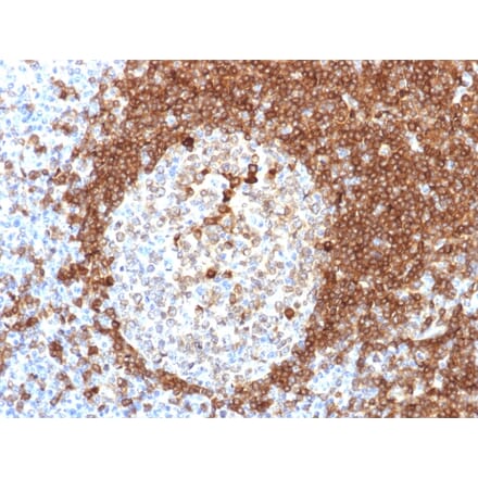 Immunohistochemistry - Anti-CD79a Antibody [HM57] (A250789) - Antibodies.com
