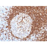 Immunohistochemistry - Anti-CD79a Antibody [HM57] (A250789) - Antibodies.com