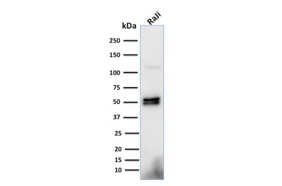 Western Blot - Anti-CD79a Antibody [HM57] (A250789) - Antibodies.com