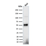 Western Blot - Anti-CD79a Antibody [HM57] (A250789) - Antibodies.com