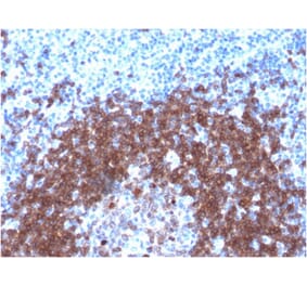 Immunohistochemistry - Anti-CD79a Antibody [IGA/1790R] (A250790) - Antibodies.com