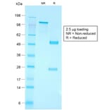 SDS-PAGE - Anti-CD79a Antibody [IGA/1790R] (A250790) - Antibodies.com