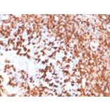 Immunohistochemistry - Anti-CD79a Antibody [IGA/3939R] (A250791) - Antibodies.com
