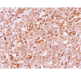 Immunohistochemistry - Anti-CD79a Antibody [IGA/1688R] (A250792) - Antibodies.com