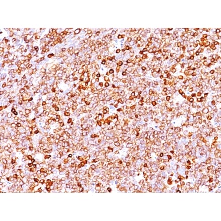 Immunohistochemistry - Anti-CD79a Antibody [IGA/1688R] (A250792) - Antibodies.com