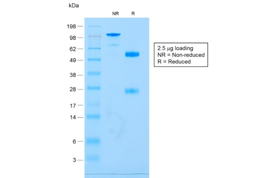 SDS-PAGE - Anti-CD79a Antibody [IGA/1688R] (A250792) - Antibodies.com