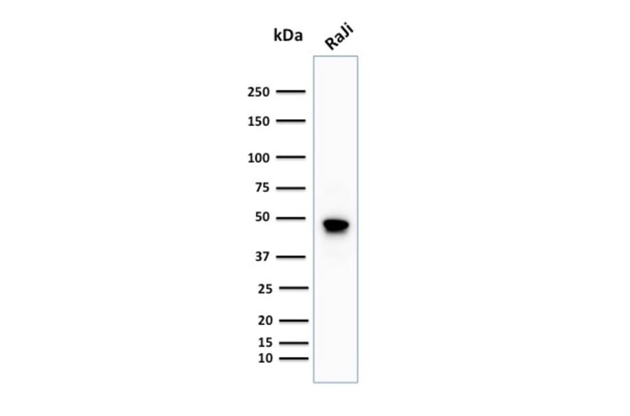 Western Blot - Anti-CD79a Antibody [IGA/1688R] (A250792) - Antibodies.com