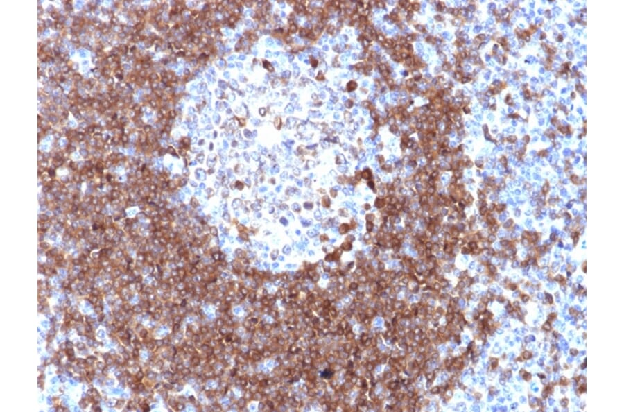 Immunohistochemistry - Anti-CD79a Antibody (A250792) - Antibodies.com