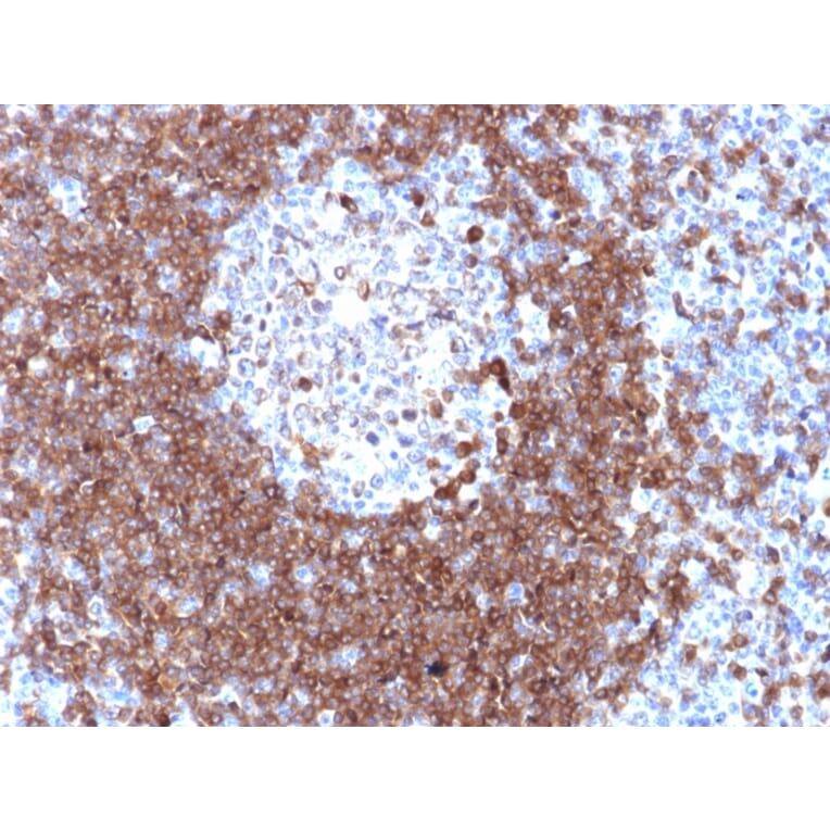 Immunohistochemistry - Anti-CD79a Antibody (A250792) - Antibodies.com