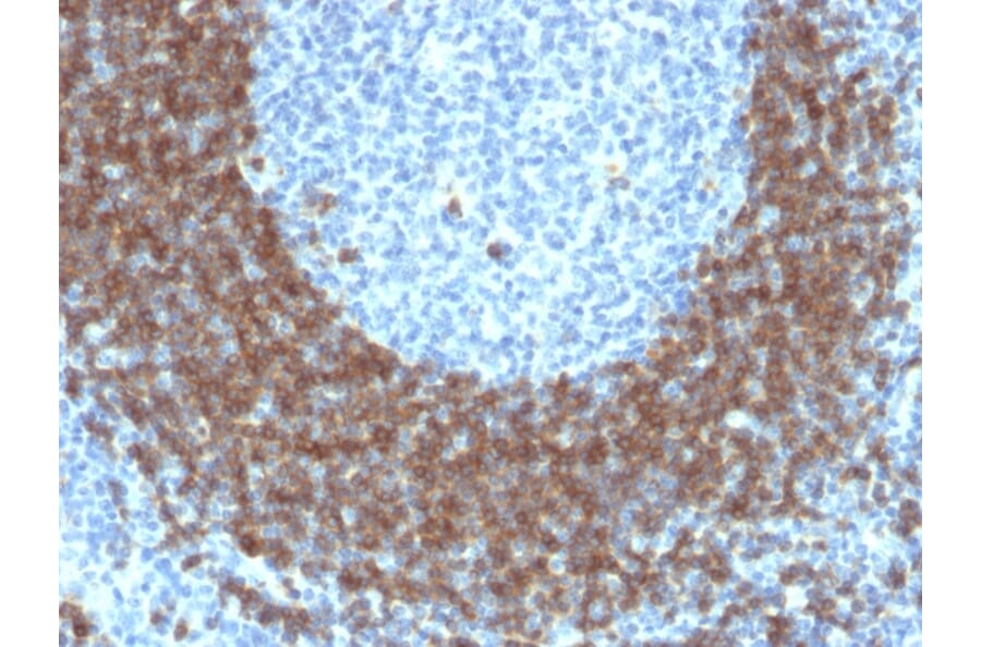 Immunohistochemistry - Anti-CD79b Antibody [IGB/1842] (A250793) - Antibodies.com