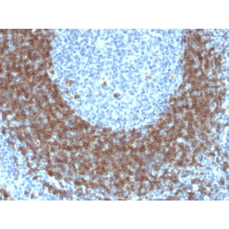 Immunohistochemistry - Anti-CD79b Antibody [IGB/1842] (A250793) - Antibodies.com