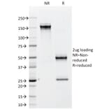 SDS-PAGE - Anti-CD79b Antibody [IGB/1842] (A250794) - Antibodies.com