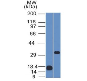 Western Blot - Anti-CD79b Antibody [IGB/1843] (A250795) - Antibodies.com