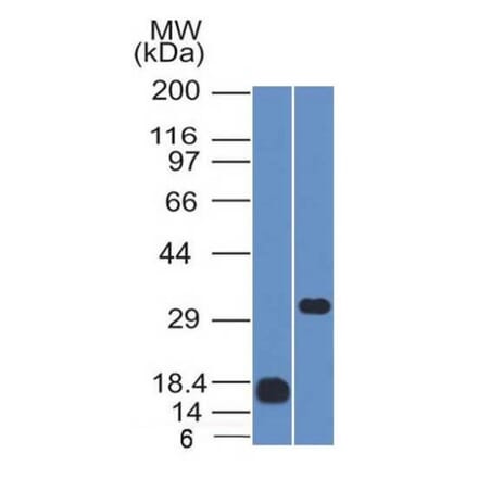 Western Blot - Anti-CD79b Antibody [IGB/1843] (A250795) - Antibodies.com