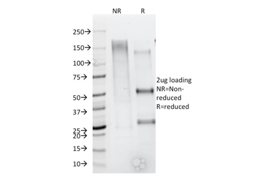 SDS-PAGE - Anti-CD79b Antibody [IGB/1844] (A250796) - Antibodies.com