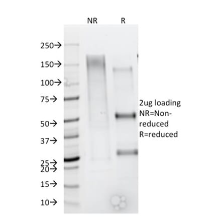 SDS-PAGE - Anti-CD79b Antibody [IGB/1844] (A250796) - Antibodies.com