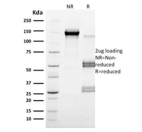 SDS-PAGE - Anti-CD79b Antibody [IGB/2555] (A250797) - Antibodies.com