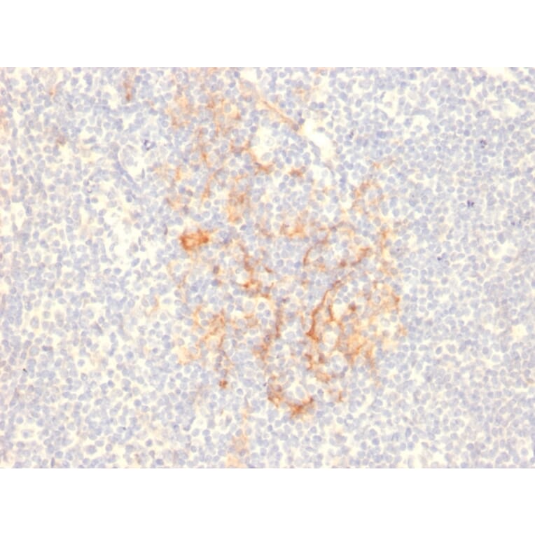 Immunohistochemistry - Anti-CD79b Antibody [IGB/2555] (A250796) - Antibodies.com