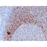 Immunohistochemistry - Anti-CD79b Antibody [B29/123] (A250798) - Antibodies.com