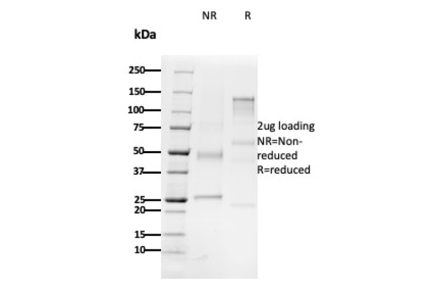 SDS-PAGE - Anti-CD79b Antibody [B29/123] (A250798) - Antibodies.com