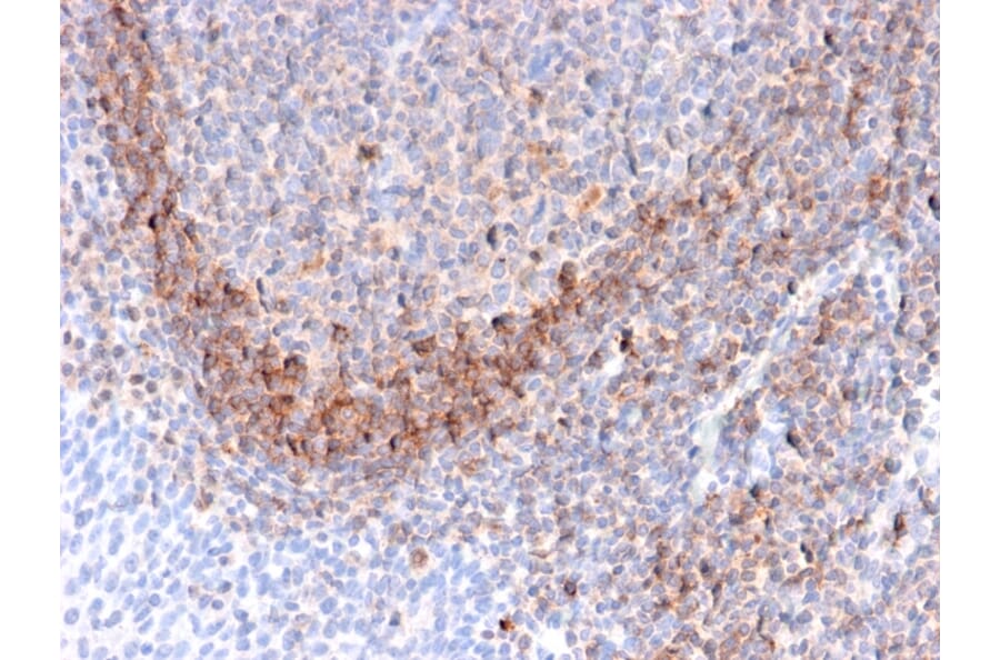 Immunohistochemistry - Anti-CD79b Antibody [B29/123] (A250797) - Antibodies.com