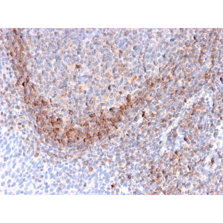 Immunohistochemistry - Anti-CD79b Antibody [B29/123] (A250797) - Antibodies.com