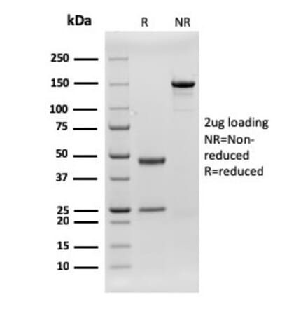SDS-PAGE - Anti-CD79b Antibody [rIGB/1842] (A250798) - Antibodies.com