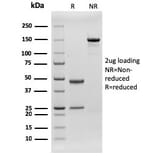 SDS-PAGE - Anti-CD79b Antibody [rIGB/1842] (A250798) - Antibodies.com
