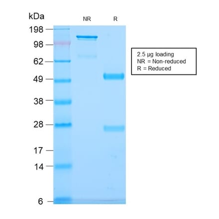 SDS-PAGE - Anti-CD79b Antibody [IGB/2940R] (A250799) - Antibodies.com