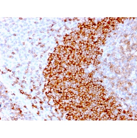 Immunohistochemistry - Anti-CD79b Antibody [IGB/3170R] (A250800) - Antibodies.com