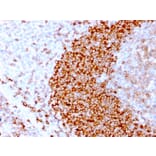 Immunohistochemistry - Anti-CD79b Antibody [IGB/3170R] (A250800) - Antibodies.com