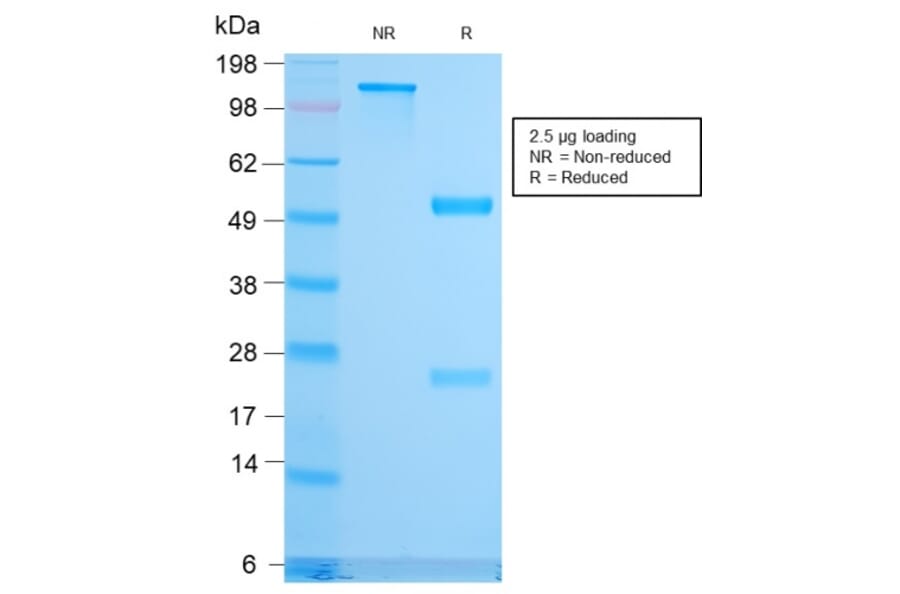 SDS-PAGE - Anti-CD79b Antibody [IGB/3170R] (A250801) - Antibodies.com